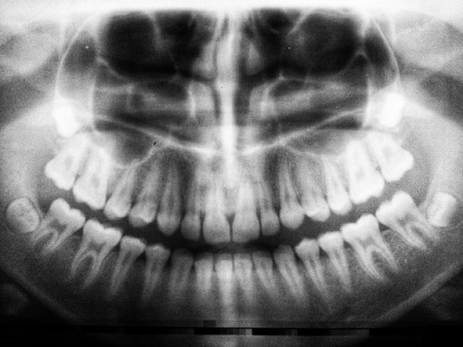 ■歯科助手の勉強：レントゲンの見かた